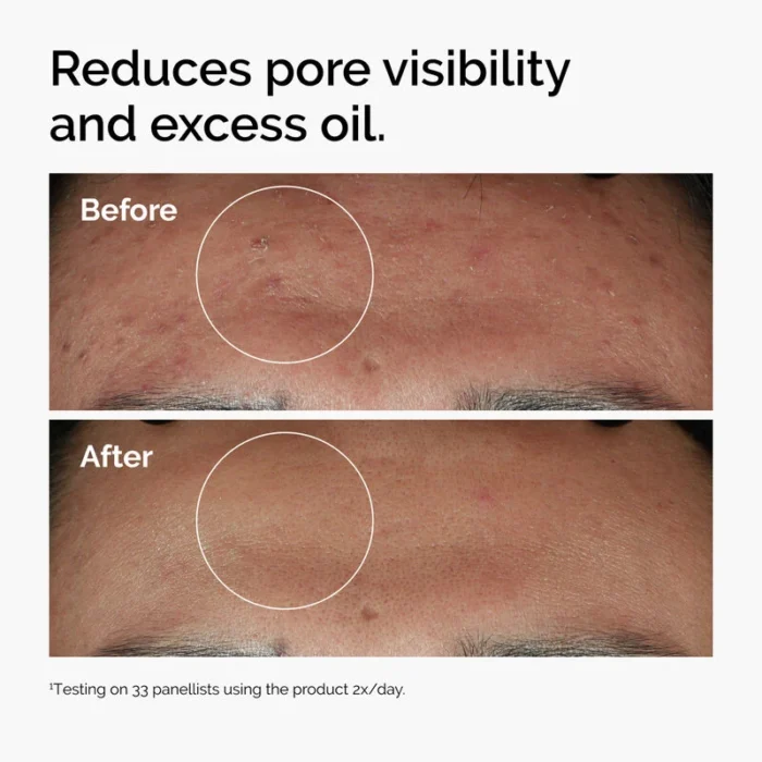 The Ordinary - Niacinamide 10% + Zinc 1% - Imagen de 4